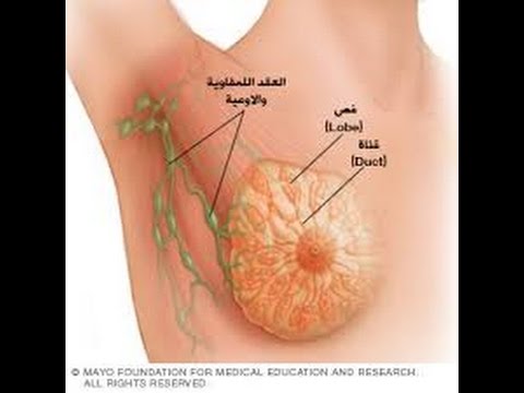 امراض الثدي عند البنات بالصور،امراض تصيب الثدي للفتيات 6676