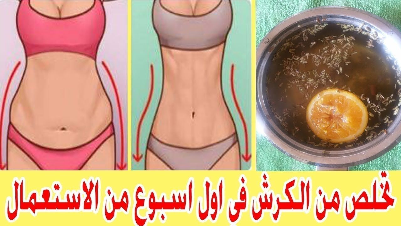 تنحيف الكرش , القضاء علي الكرش والخطوط البيضاء