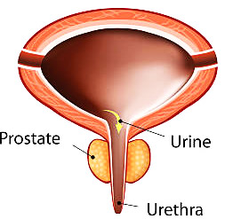 ضيق مجرى البول وضعف الانتصاب , معلومات تهمك