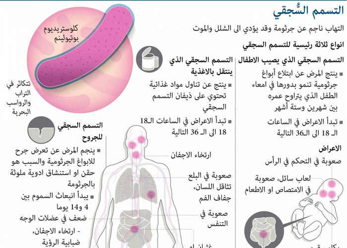 ماهي اعراض التسمم انواع التسمم التي تؤدي الي الوفاء