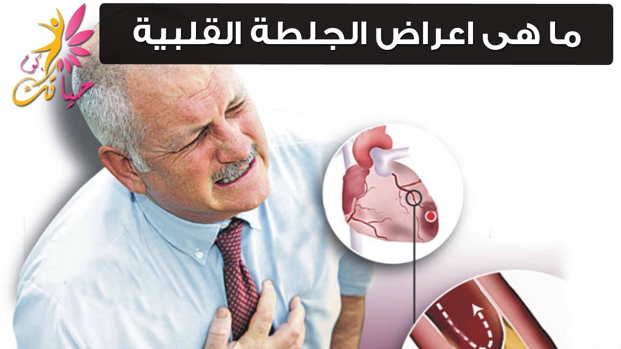 اسباب الجلطة القلبية , اعراض واسباب وعلاج الجلطه القلبيه