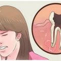 1465 2 علاج وجع الاسنان - طريقة معالجة الاسنان معاني علاء