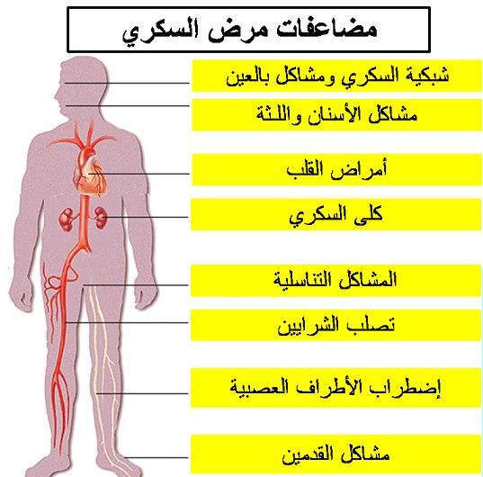 اضرار مرض السكر , مخاطر الاصابة بمرض السكر