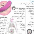 6727 1 ماهي اعراض التسمم انواع التسمم التي تؤدي الي الوفاء معاني علاء